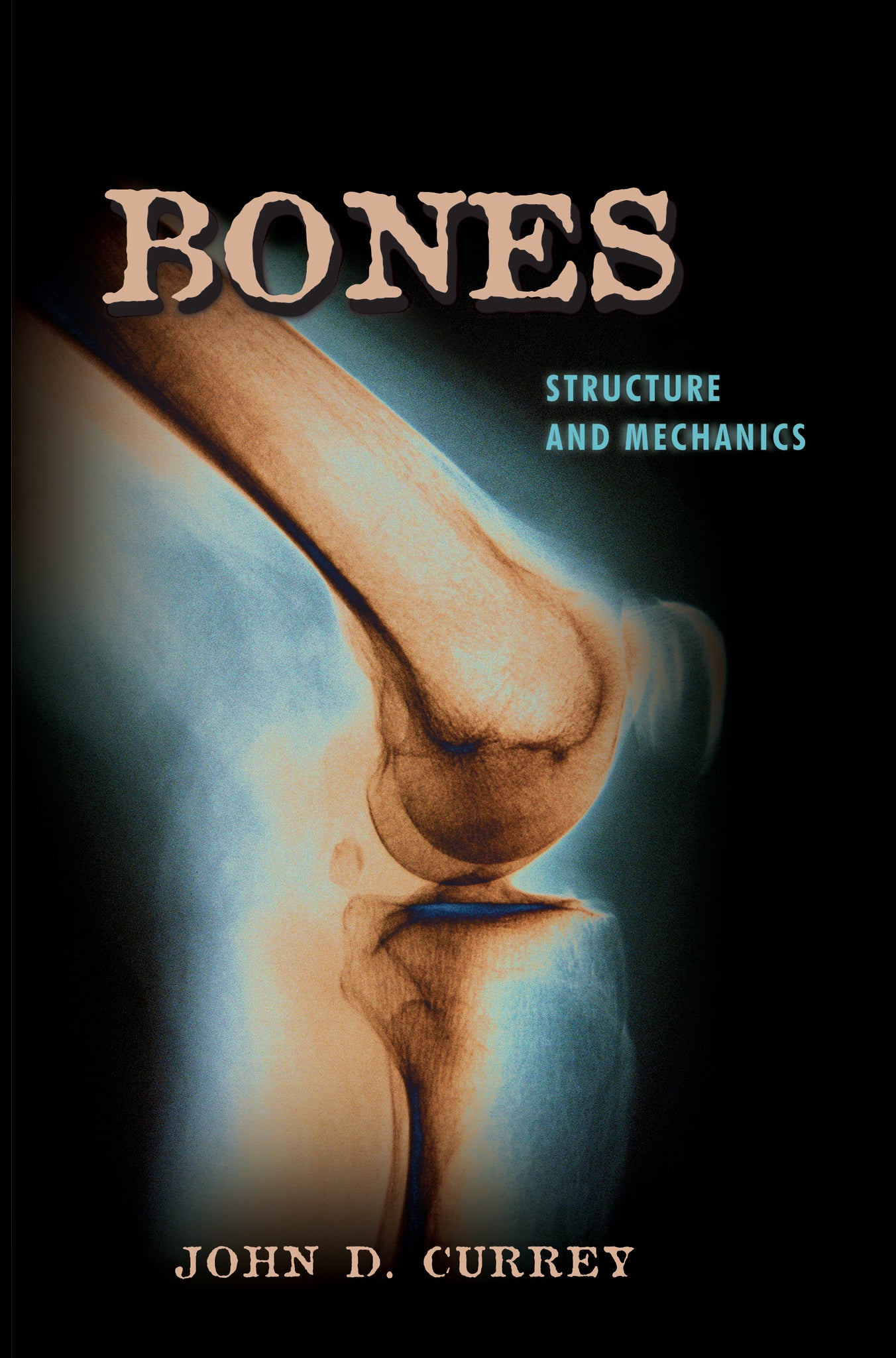 Bones